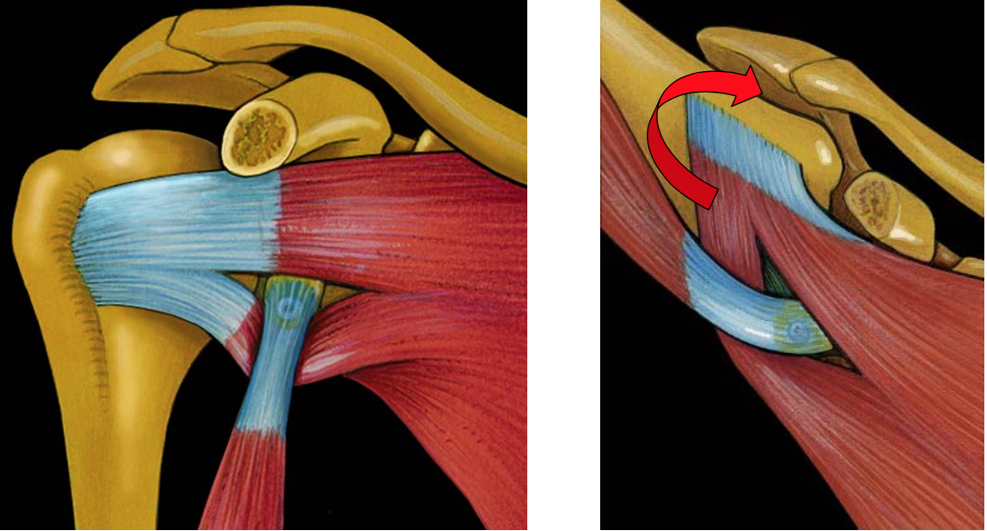 De instabiele schouder (arm uit de kom) - Rijnland Orthopaedie